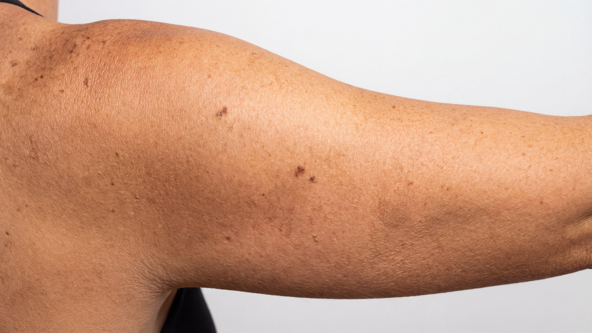 How to Choose the Right Sunscreen for Your Skin Type